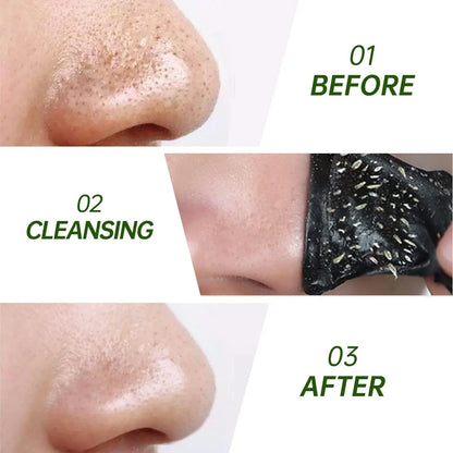 Transform Your Skin with Mighty Deep Cleansing Nose Strips for Blackhead Removal - Charcoal & Witch Hazel, 10 Count